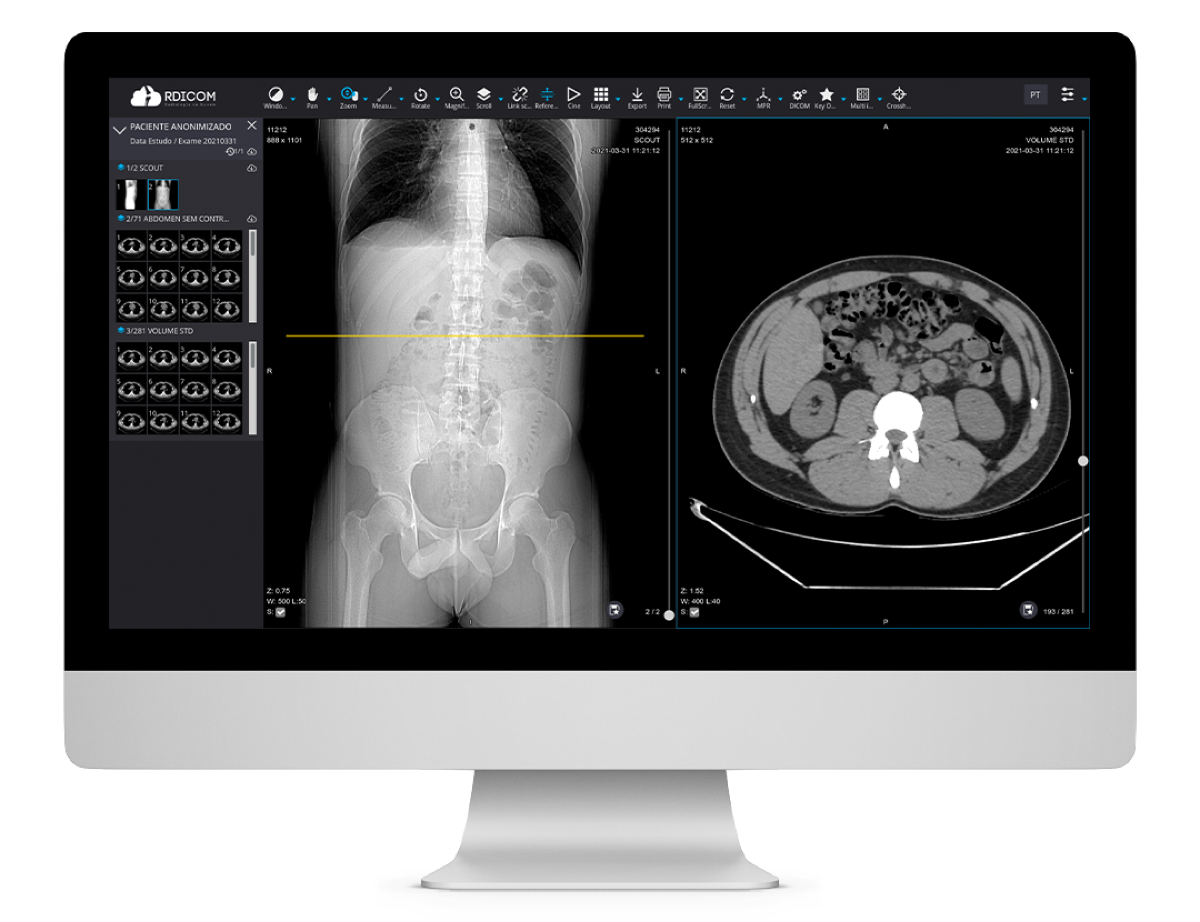 Rdicom DICOM viewer interface with medical imaging tools